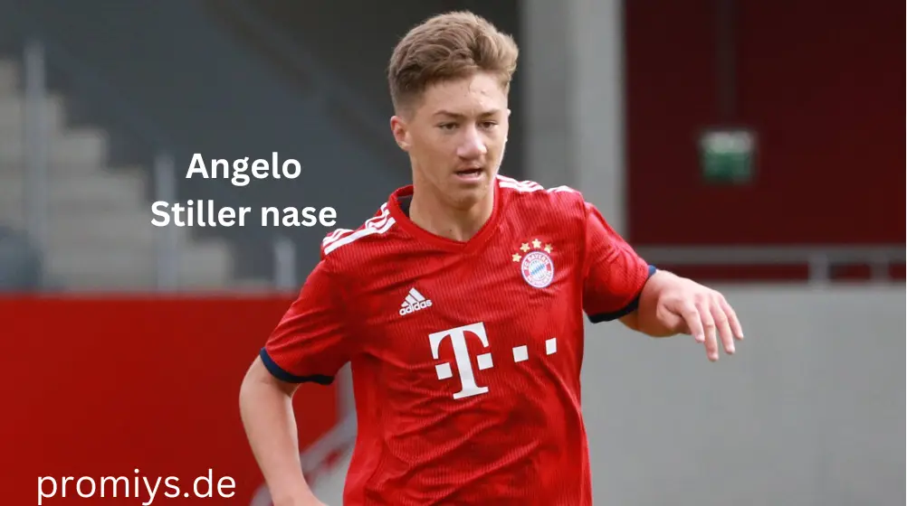 Angelo Stiller nase